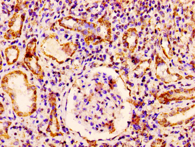 RAB3GAP1 Antibody in Immunohistochemistry (Paraffin) (IHC (P))