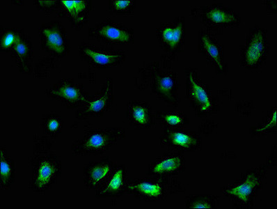 TRADD Antibody in Immunocytochemistry (ICC/IF)