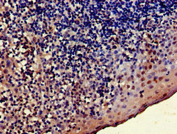 TRADD Antibody in Immunohistochemistry (Paraffin) (IHC (P))