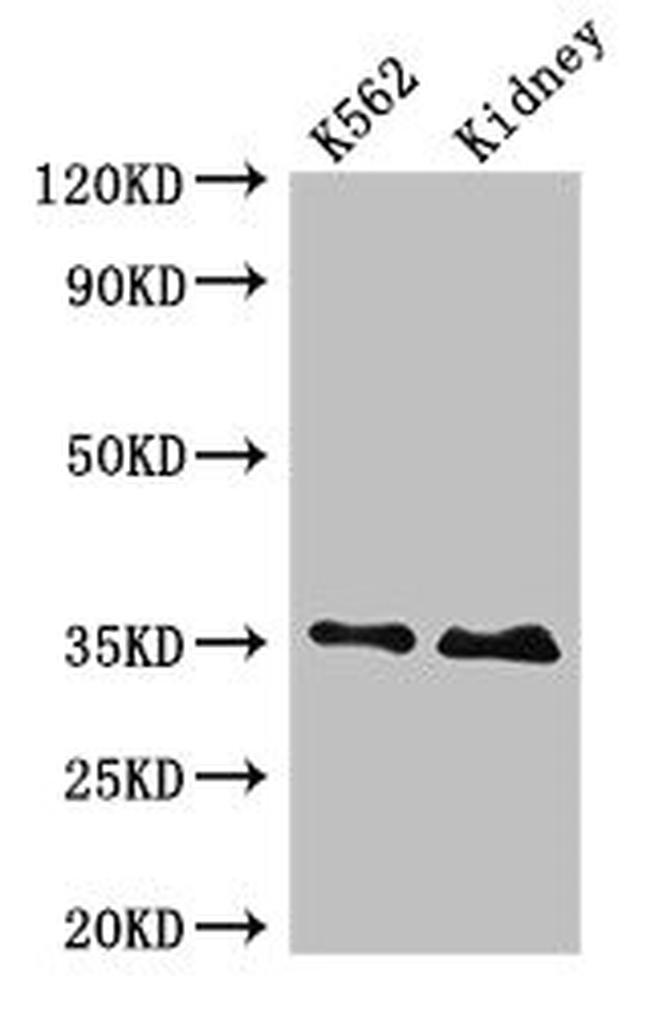 TRADD Antibody in Western Blot (WB)