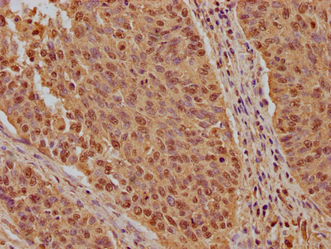 KPNB1 Antibody in Immunohistochemistry (Paraffin) (IHC (P))