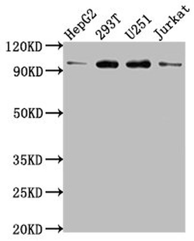 KPNB1 Antibody in Western Blot (WB)