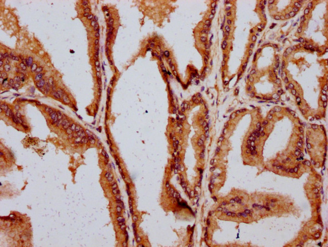 DAZAP2 Antibody in Immunohistochemistry (Paraffin) (IHC (P))