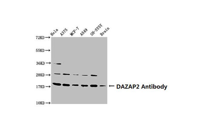 DAZAP2 Antibody in Western Blot (WB)