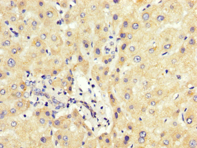 PCBP2 Antibody in Immunohistochemistry (Paraffin) (IHC (P))