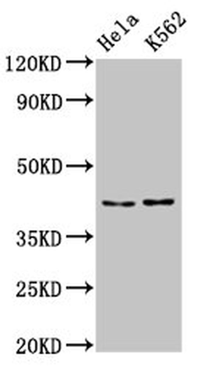 PCBP2 Antibody in Western Blot (WB)