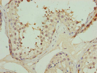 TRIP13 Antibody in Immunohistochemistry (Paraffin) (IHC (P))