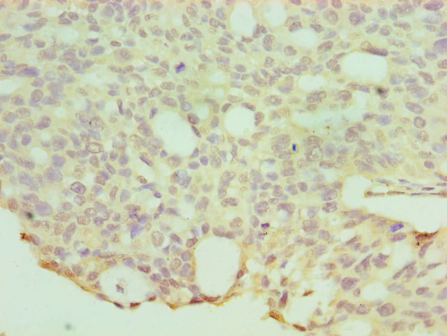 HYAL1 Antibody in Immunohistochemistry (Paraffin) (IHC (P))