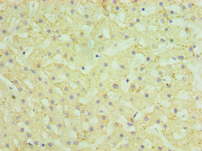 HYAL1 Antibody in Immunohistochemistry (Paraffin) (IHC (P))