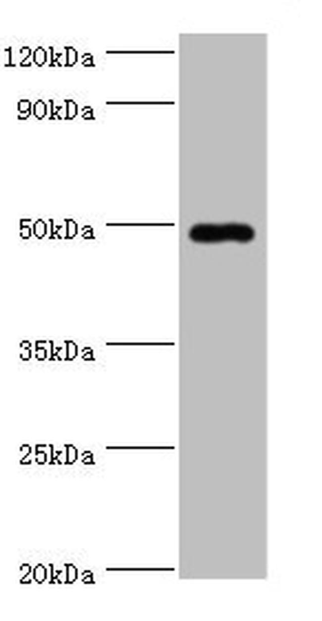 HYAL1 Antibody in Western Blot (WB)