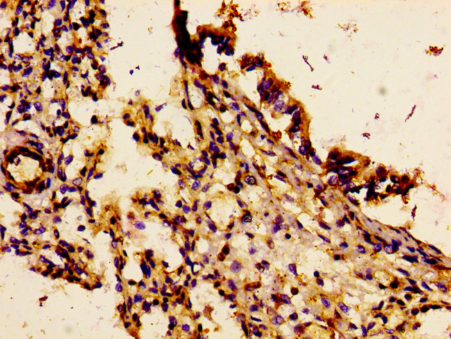 IL18R1 Antibody in Immunohistochemistry (Paraffin) (IHC (P))