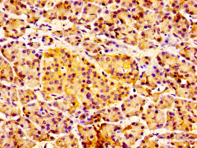 IL18R1 Antibody in Immunohistochemistry (Paraffin) (IHC (P))