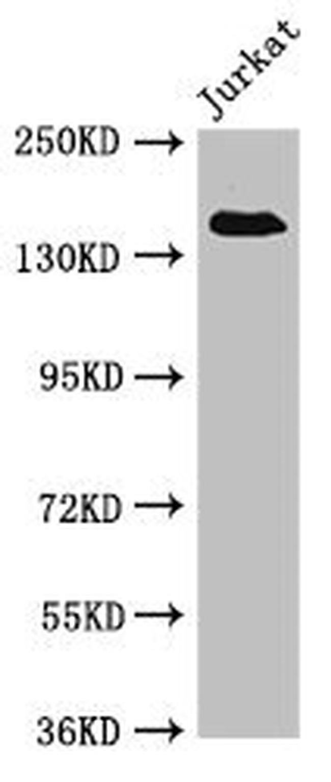 eIF3a Antibody in Western Blot (WB)