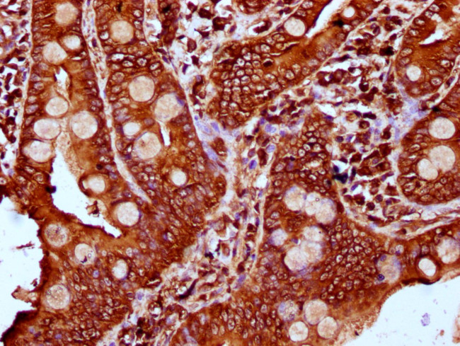 PLS1 Antibody in Immunohistochemistry (Paraffin) (IHC (P))