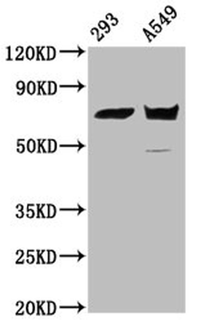 PLS1 Antibody in Western Blot (WB)