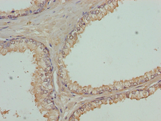 FBXO7 Antibody in Immunohistochemistry (Paraffin) (IHC (P))