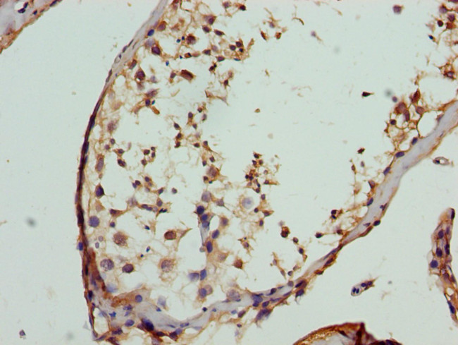 FBXO7 Antibody in Immunohistochemistry (Paraffin) (IHC (P))