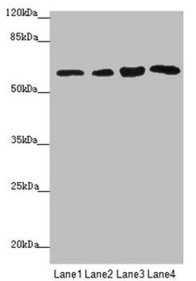 FBXO7 Antibody in Western Blot (WB)