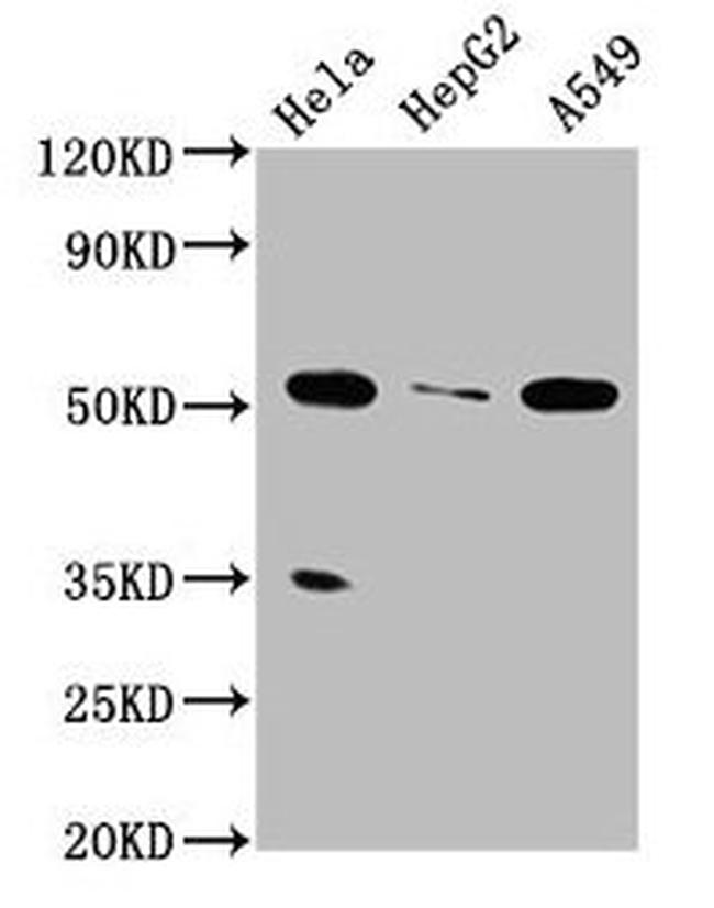 ZMYND17 Antibody in Western Blot (WB)