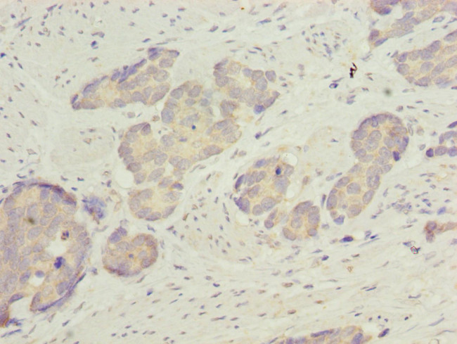 ACSBG2 Antibody in Immunohistochemistry (Paraffin) (IHC (P))