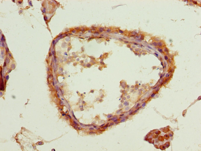 ACSBG2 Antibody in Immunohistochemistry (Paraffin) (IHC (P))