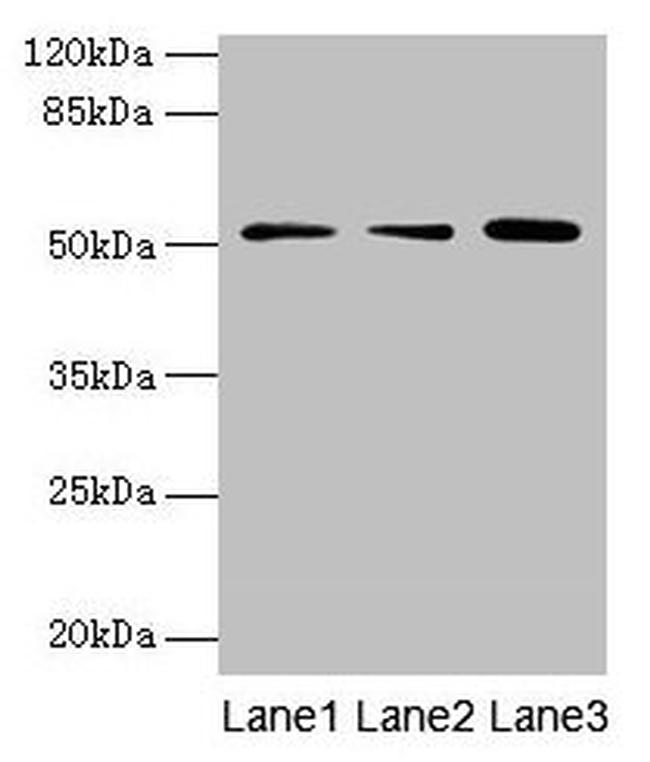 ACSBG2 Antibody in Western Blot (WB)