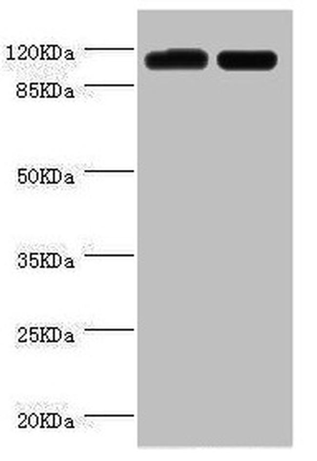 PITRM1 Antibody in Western Blot (WB)