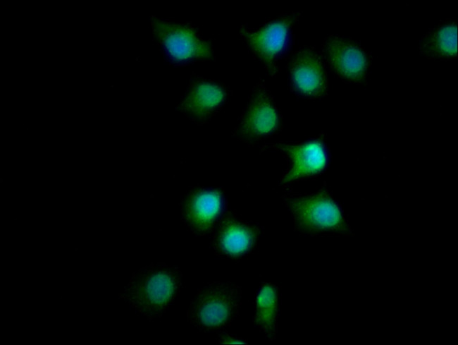 FMN1 Antibody in Immunocytochemistry (ICC/IF)