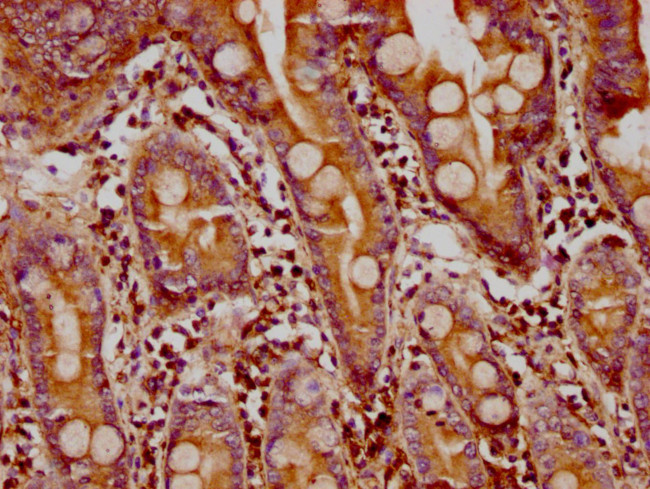 FMN1 Antibody in Immunohistochemistry (Paraffin) (IHC (P))