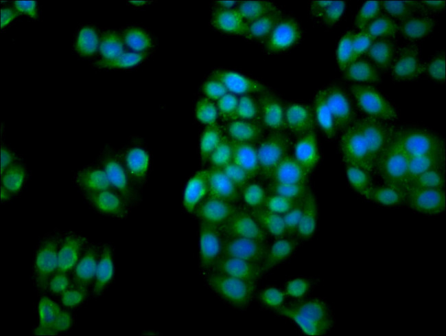 C1orf69 Antibody in Immunocytochemistry (ICC/IF)