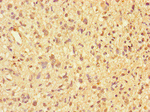 PPP2R2D Antibody in Immunohistochemistry (Paraffin) (IHC (P))