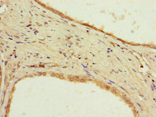 PPP2R2D Antibody in Immunohistochemistry (Paraffin) (IHC (P))