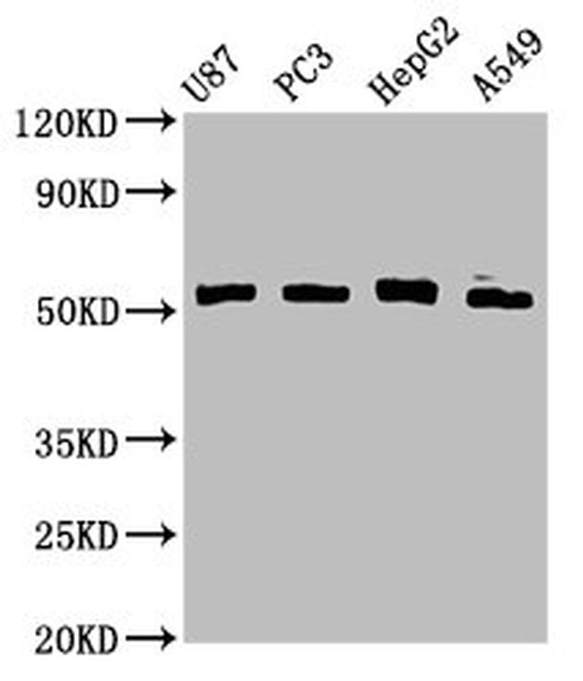 PPP2R2D Antibody in Western Blot (WB)
