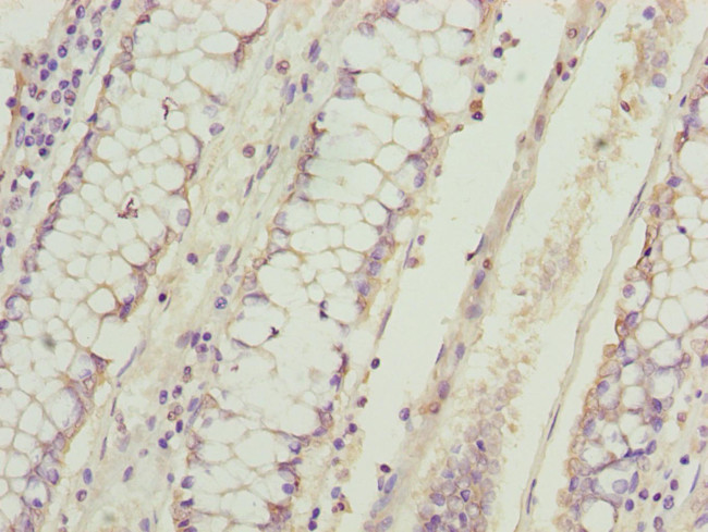 DUSP13 Antibody in Immunohistochemistry (Paraffin) (IHC (P))