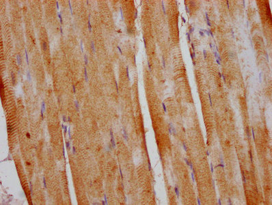 DUSP13 Antibody in Immunohistochemistry (Paraffin) (IHC (P))