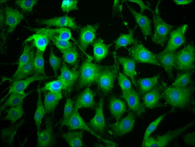 ICB-1 Antibody in Immunocytochemistry (ICC/IF)