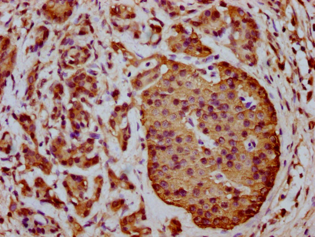 ICB-1 Antibody in Immunohistochemistry (Paraffin) (IHC (P))