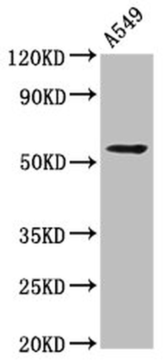 ICB-1 Antibody in Western Blot (WB)