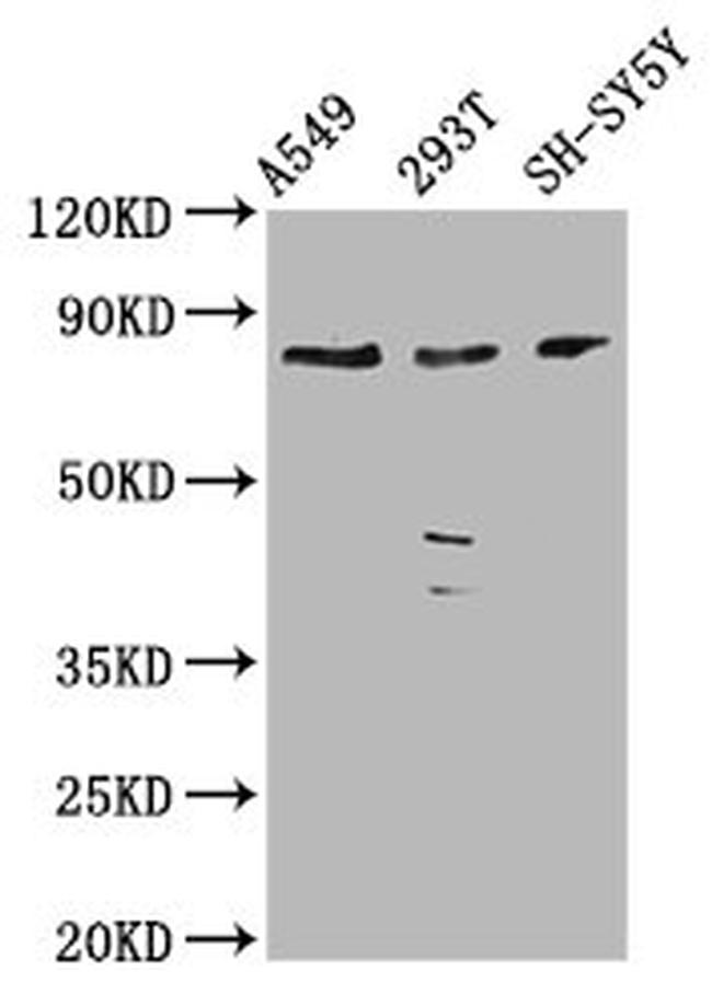 ZC3H14 Antibody in Western Blot (WB)