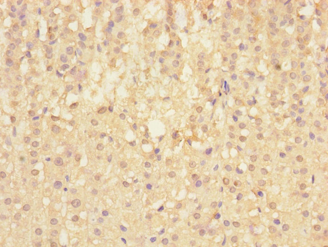 SIGIRR Antibody in Immunohistochemistry (Paraffin) (IHC (P))