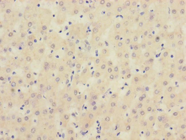 SIGIRR Antibody in Immunohistochemistry (Paraffin) (IHC (P))