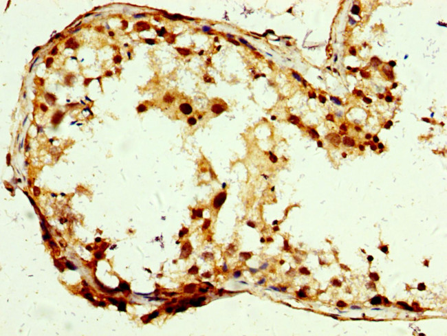 SLC25A24 Antibody in Immunohistochemistry (Paraffin) (IHC (P))