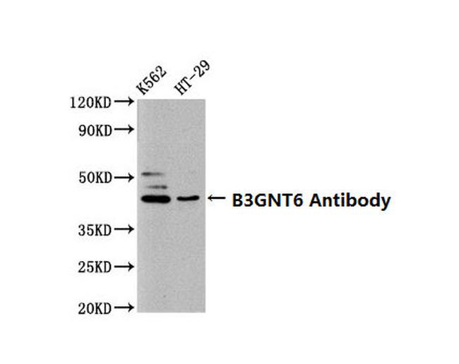 B3GNT6 Antibody in Western Blot (WB)