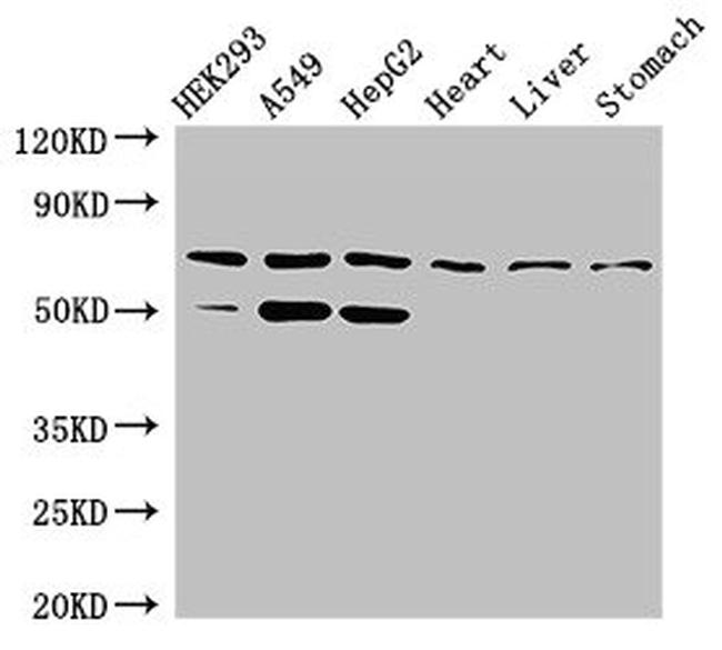 TCTN3 Antibody in Western Blot (WB)