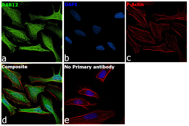 RAB12 Antibody in Immunocytochemistry (ICC/IF)