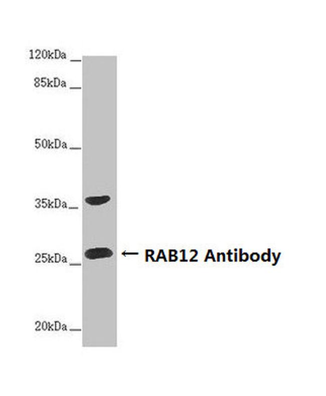 RAB12 Antibody in Western Blot (WB)