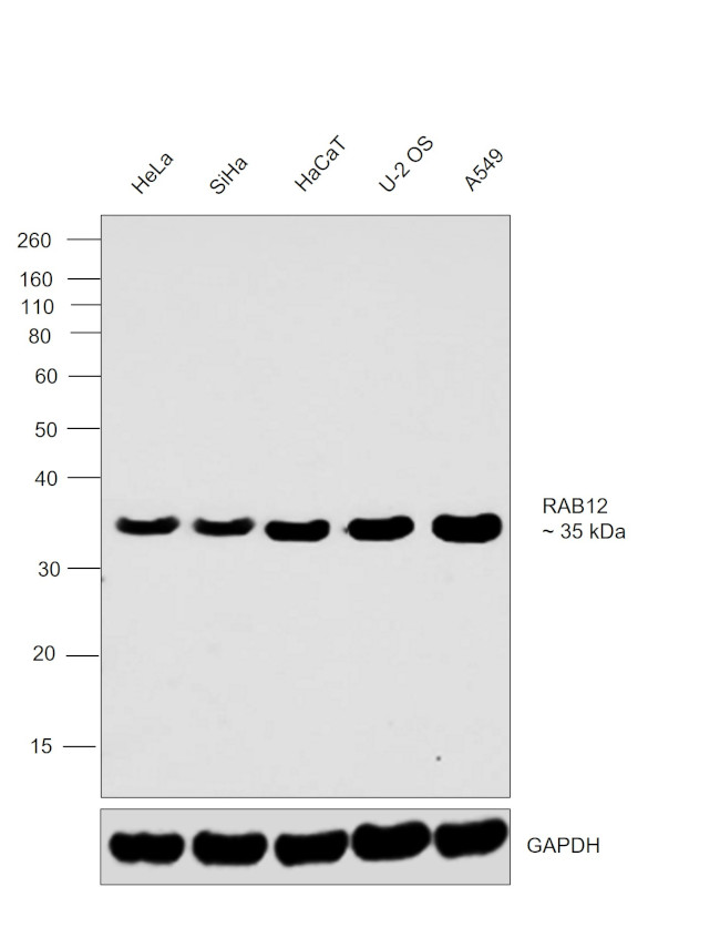 RAB12 Antibody in Western Blot (WB)