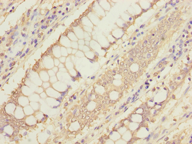 MTHFD1L Antibody in Immunohistochemistry (Paraffin) (IHC (P))