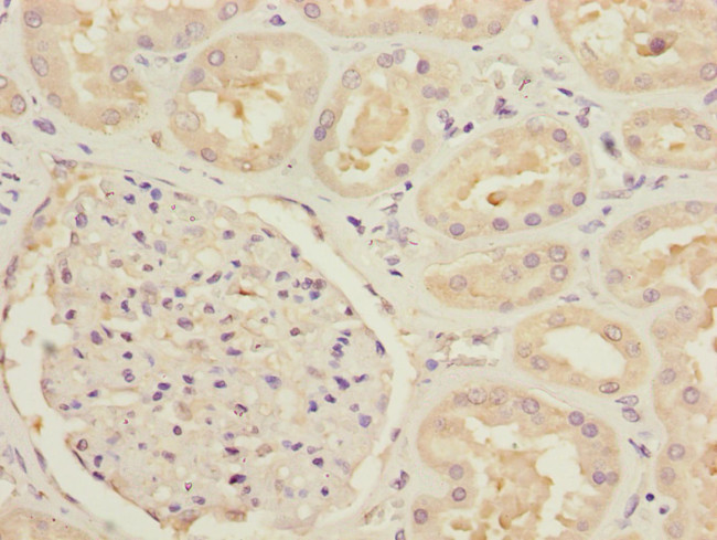 MTHFD1L Antibody in Immunohistochemistry (Paraffin) (IHC (P))