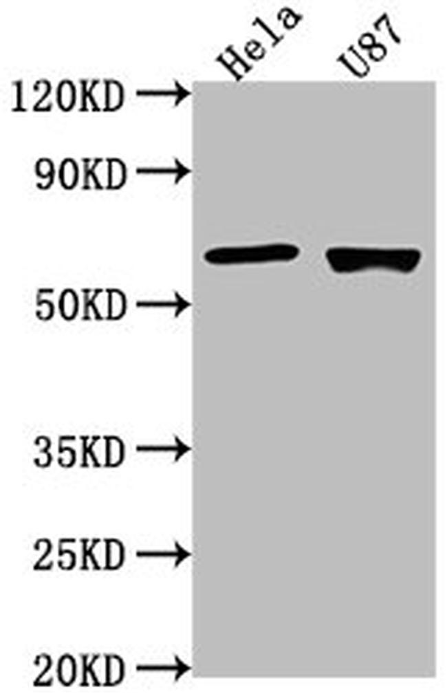 USP17L1 Antibody in Western Blot (WB)